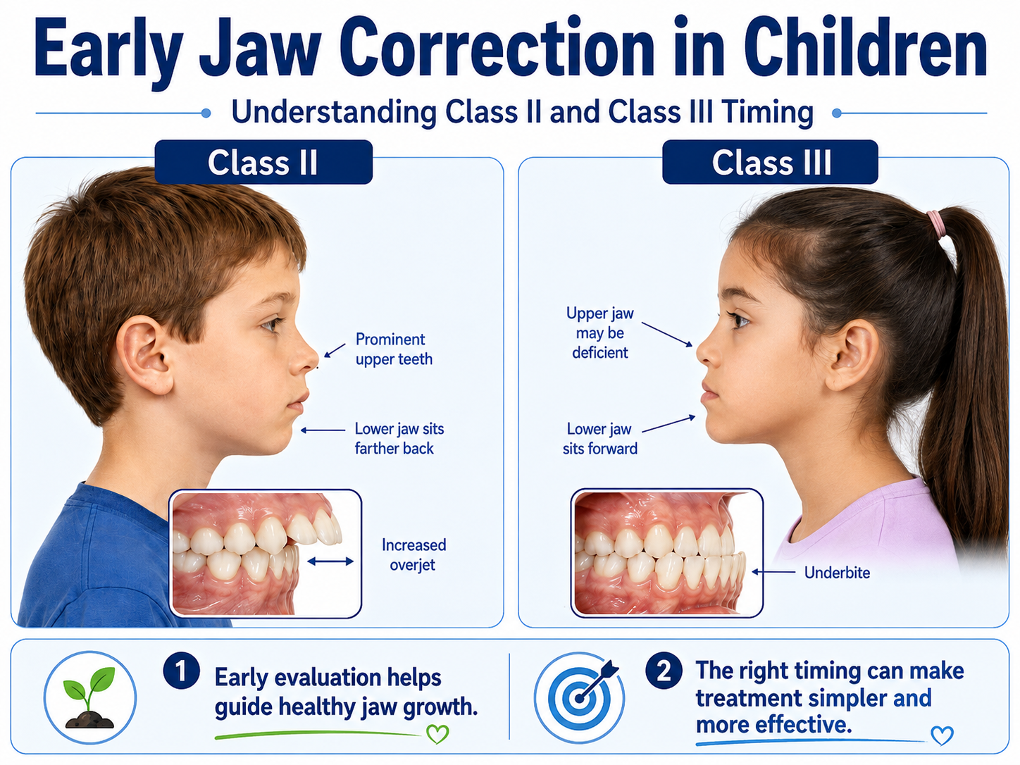 Early Jaw Correction In Children: Class II And Class III Timing