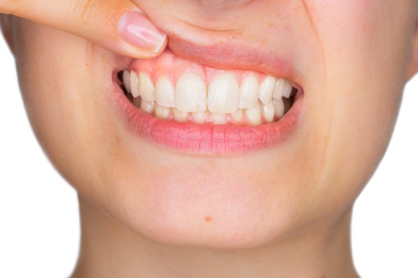 How Is Gum Disease Treated By A General Dentist?