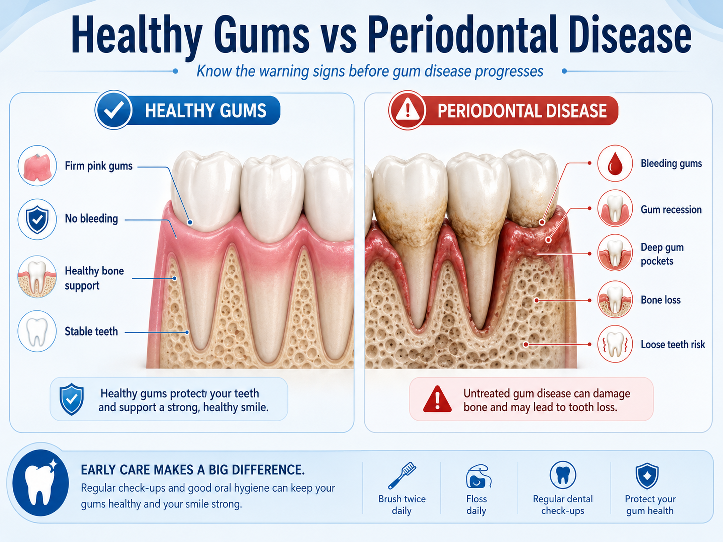 periodontal disease signs showing healthy gums compared with bleeding gums, gum recession, deep pockets, and bone loss